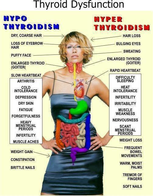Je n'arrive pas à maigrir thyroïde